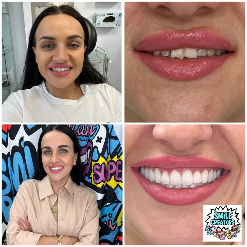 Real patient — before and after