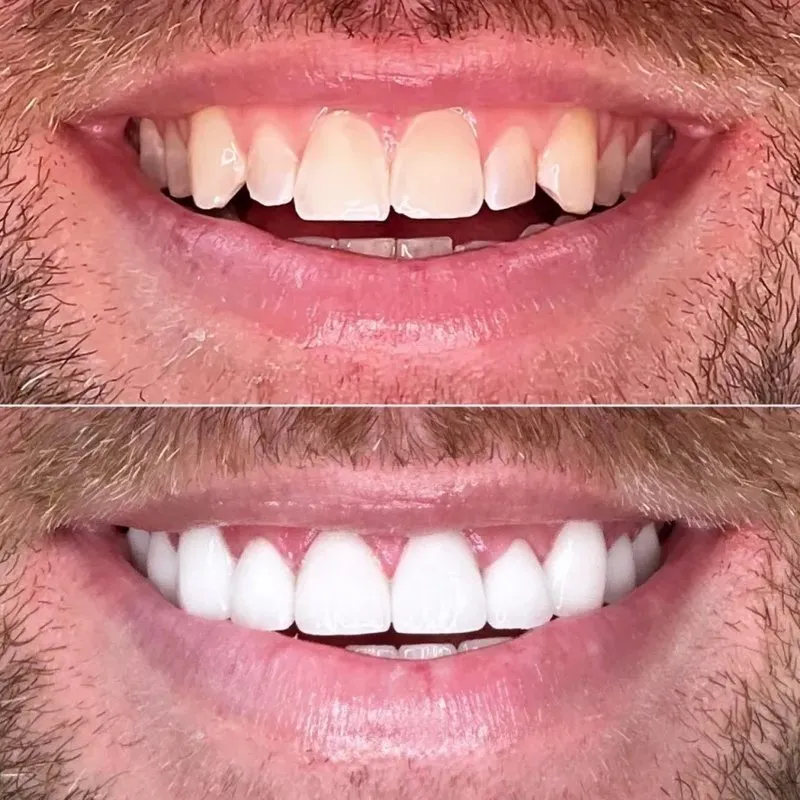Real patient — before and after
