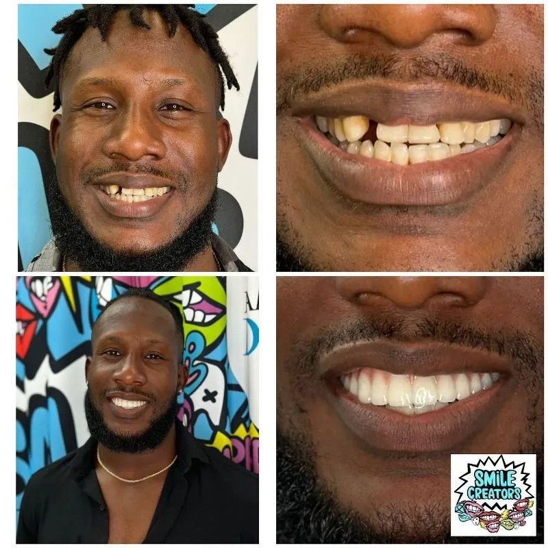Real patient — before and after