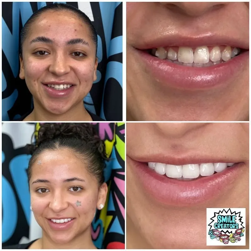 Real patient — before and after