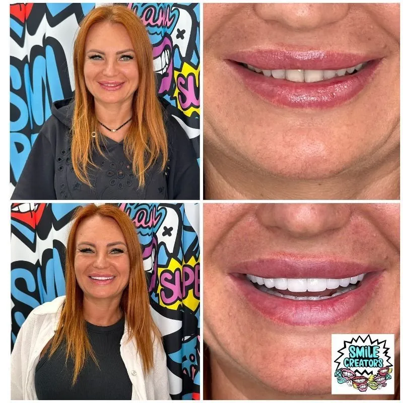 Real patient — before and after