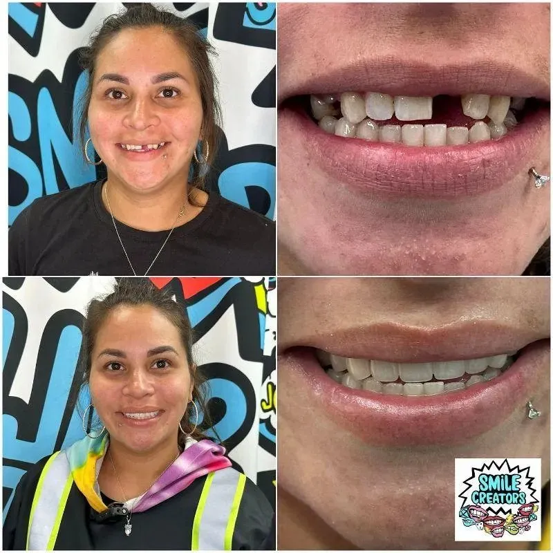 Real patient — before and after