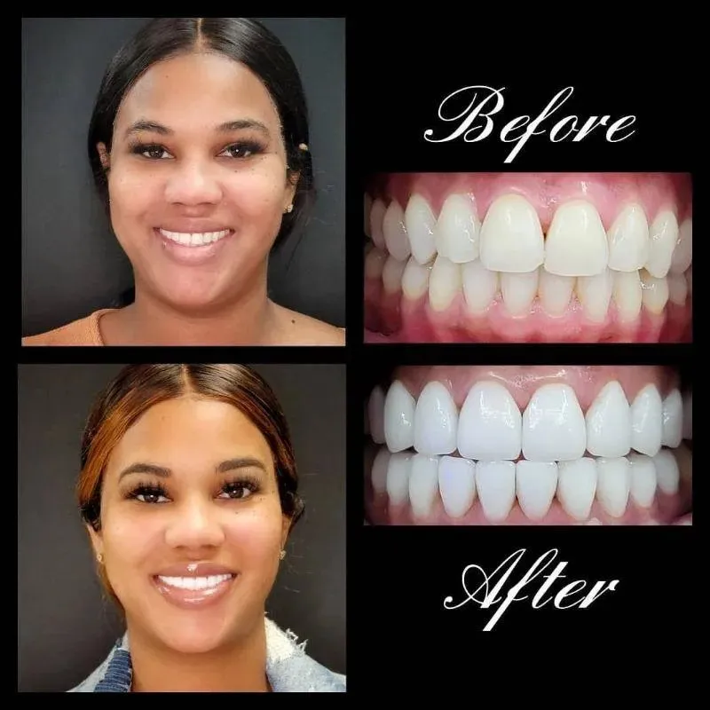 Real patient — before and after