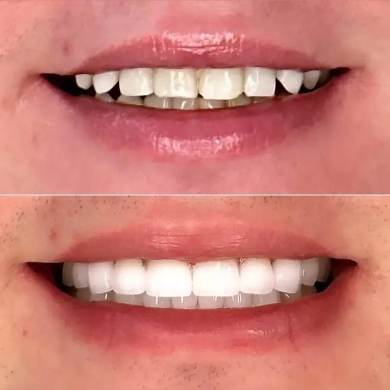 Real patient — before and after