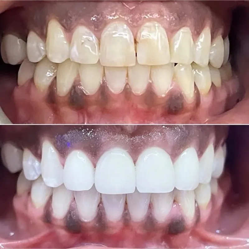 Real patient — before and after