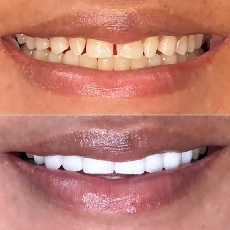 Real patient — before and after