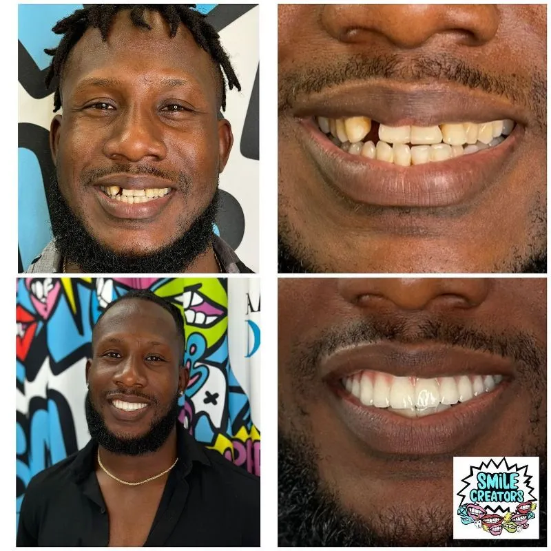 A man with a beard and missing teeth is smiling