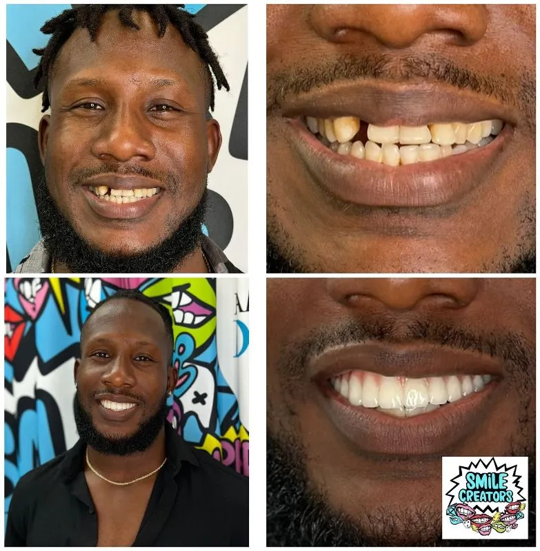 A man with a beard and missing teeth is smiling